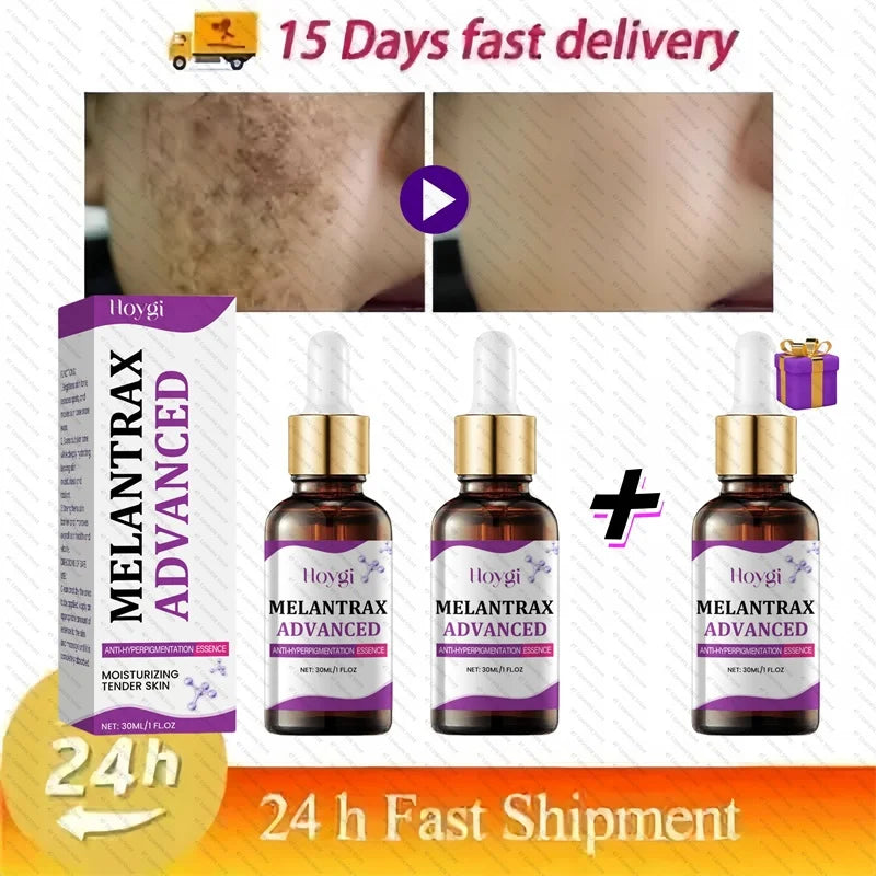 Dark Spots Remover Whitening Serum Face Freckle Melanin Correcting Anti Pigmentation Brighten Beauty Korean Day Night Skin Care Buy 2 Get 1 Free