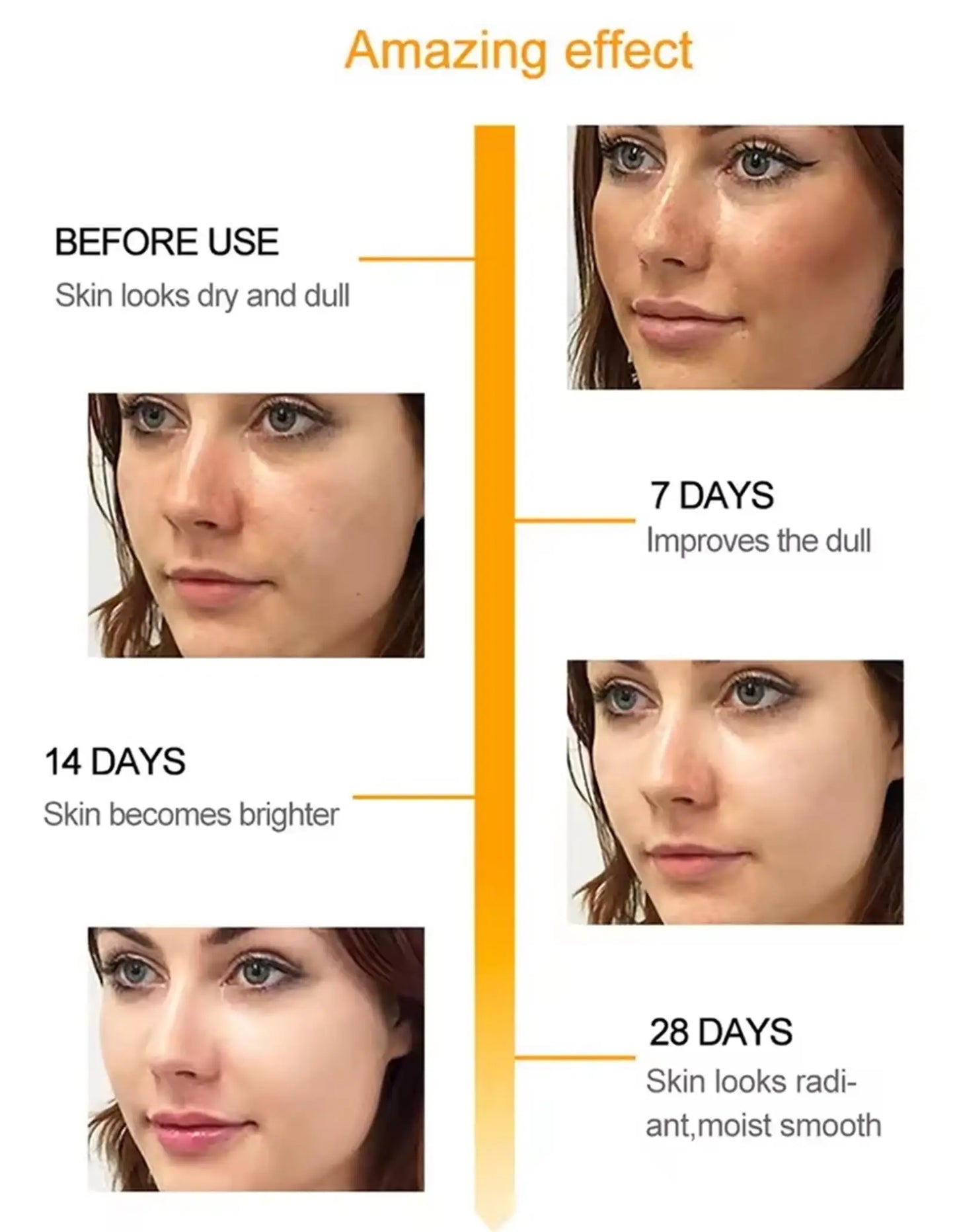 Whitening Freckle Cream Melasma Dark Spots Pigmentation Removal Product Fade Stain Melanin Fast Repair Brighten Korean Skin Care