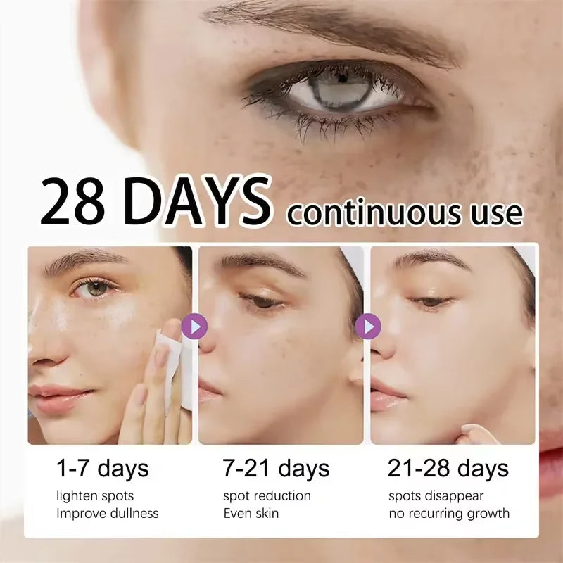 Powerful Dark Spots Remover Freckle Whitening Serum Melanin Correcting Anti Pigmentation Brighten Korean Day Night Facial Care
