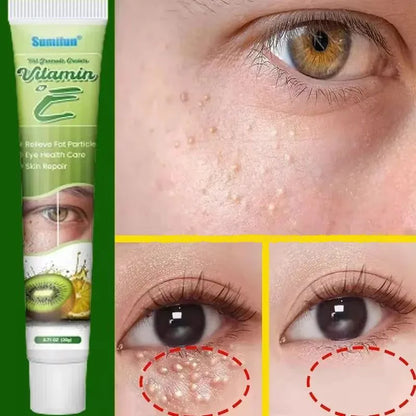 Fat Granules Remover Eye Cream Skin Care Products