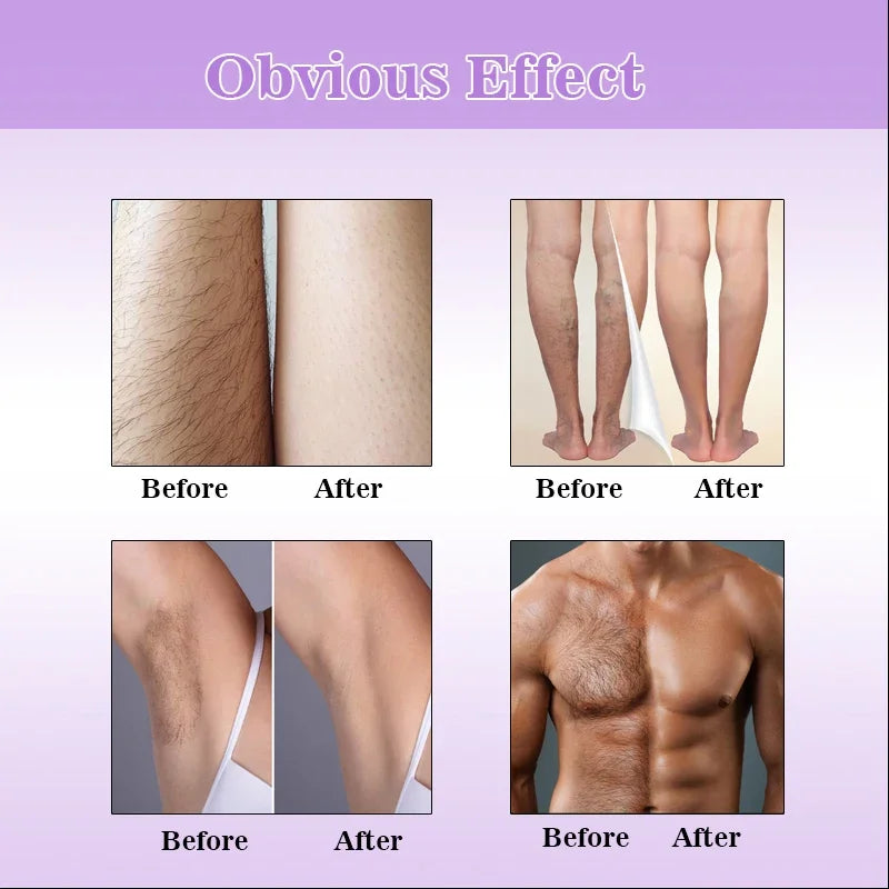 Permanent, painless hair removal spray, axila, legs, arms, hair remover, hair growth inhibitor, nutritious repair, body care