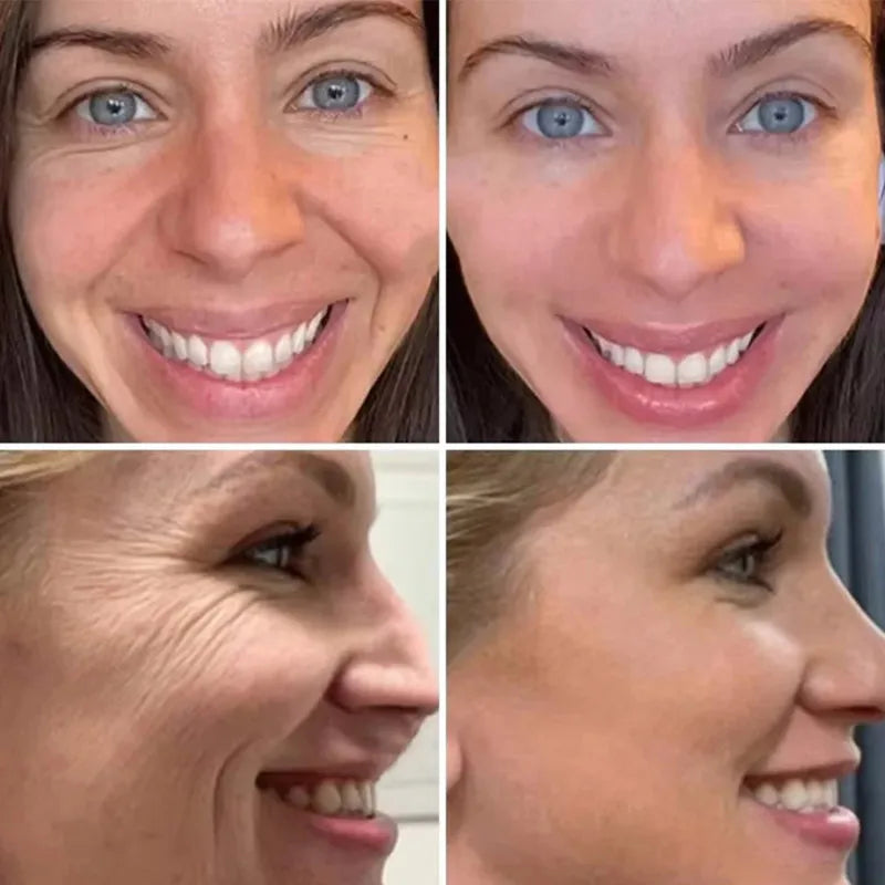 Retinol Wrinkle Remover Face Set Instant Firming Lifting Anti-Aging Serum Fade Fine Lines Whitening Korean Skin Care Products