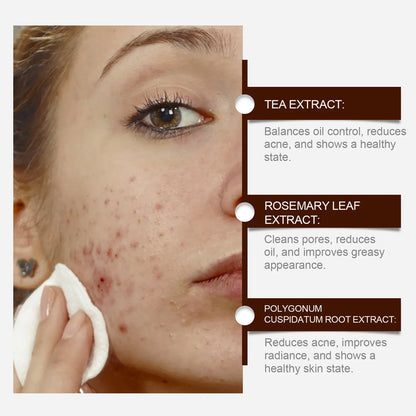 Pimple Acne Treatment Face Cream Nourish Balance Oil Control Refreshing Repairing Pimple Remover Acne Removing Cleansing Cream