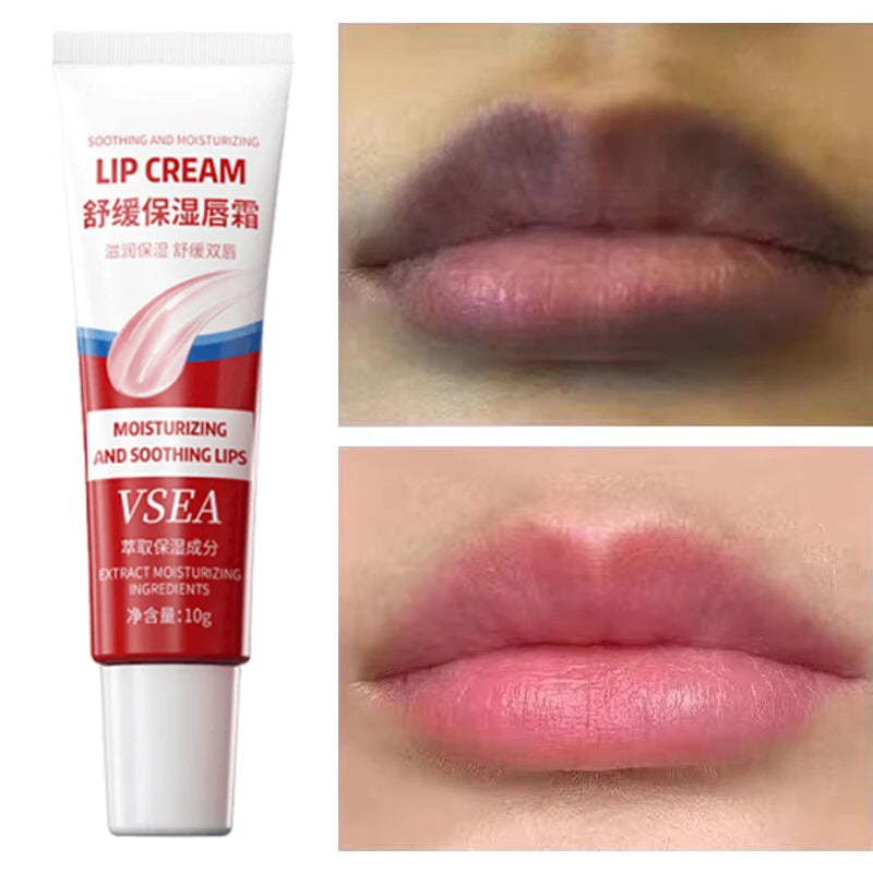 Remove Dark Lip Balm Fast Lightening Pink Lip Exfoliating Fade Lip Line Dead Skin Moisturizer Korean Care Products Beauty Health 1PC