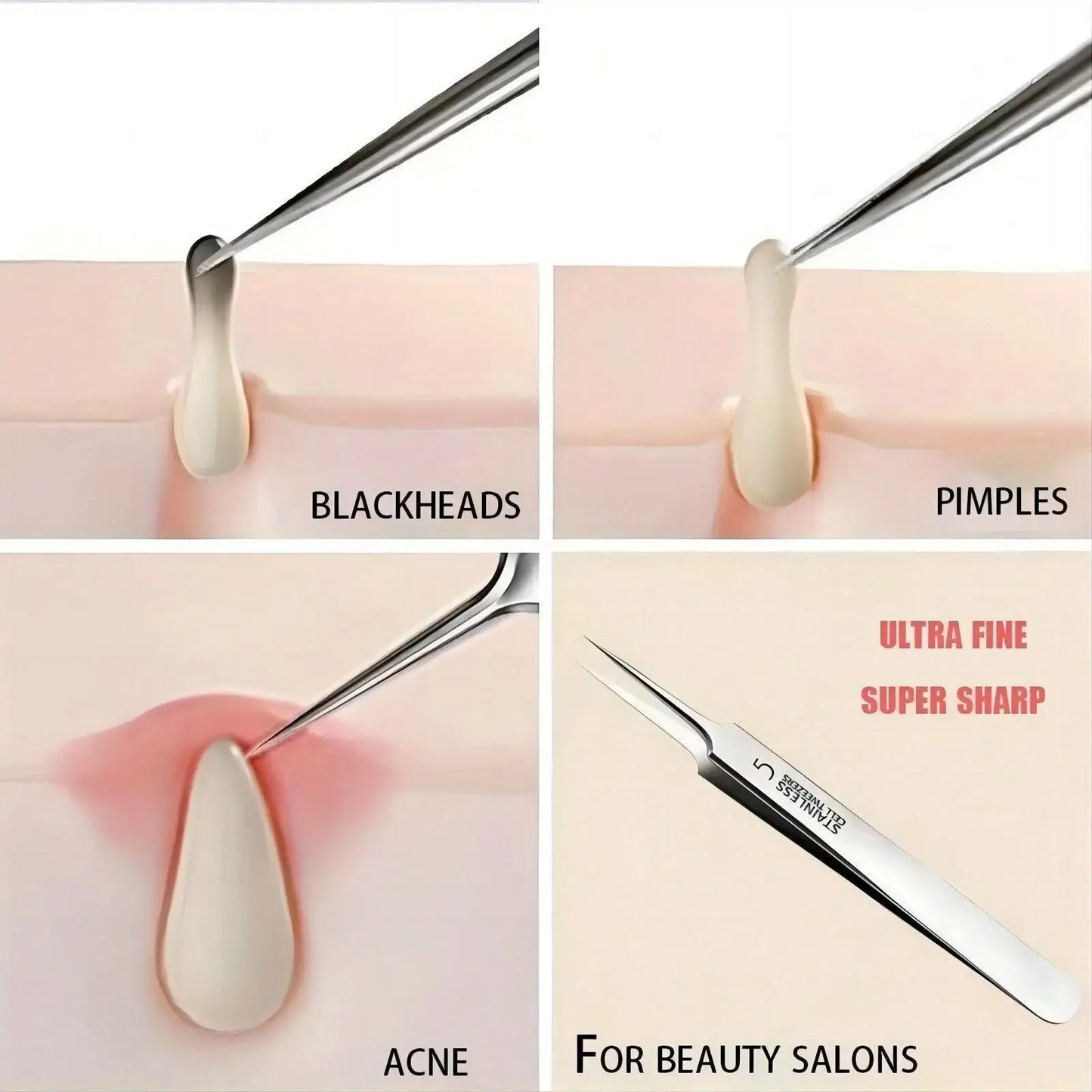 Extra Fine Cellular Acne Blackhead Tweezers - Facial Beauty Remove Acne Needle Tools for Skin Care,Blemish and Whitehead Removal