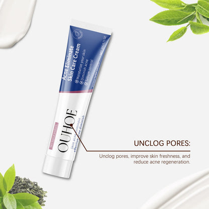 Pimple Acne Treatment Face Cream Nourish Balance Oil Control Refreshing Repairing Pimple Remover Acne Removing Cleansing Cream