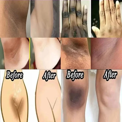 Nicotinamide Brightening Cream For Dark Skin Effective Lighten Thigh Inner Bleach Remove Melanin Private Parts Brighten Cream