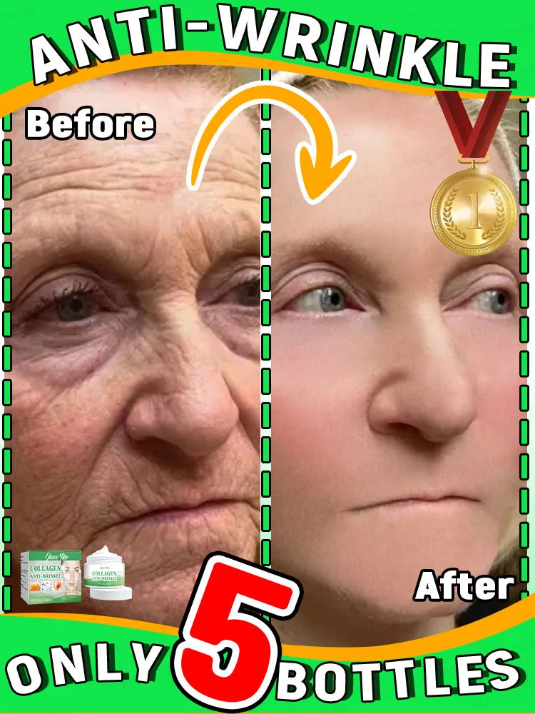 Wrinkles disappear in just 7 days