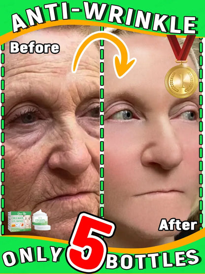 Wrinkles disappear in just 7 days