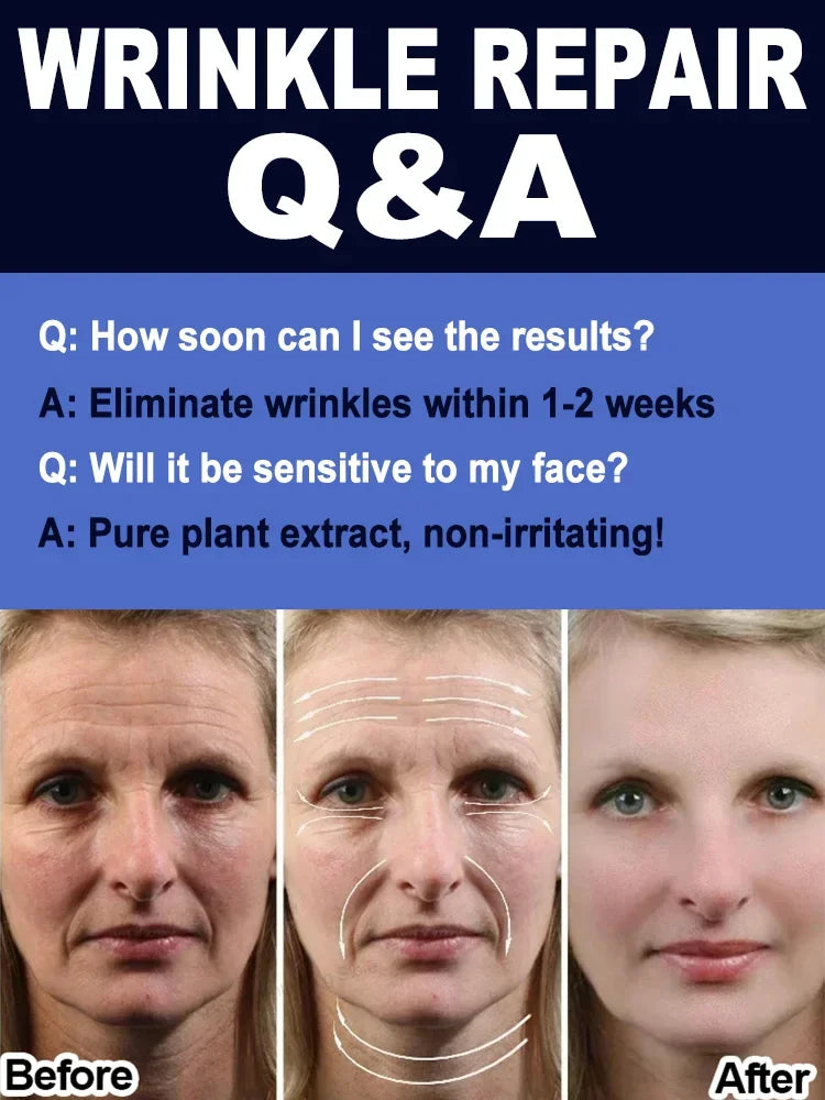 wrinkles disappear become beautiful now