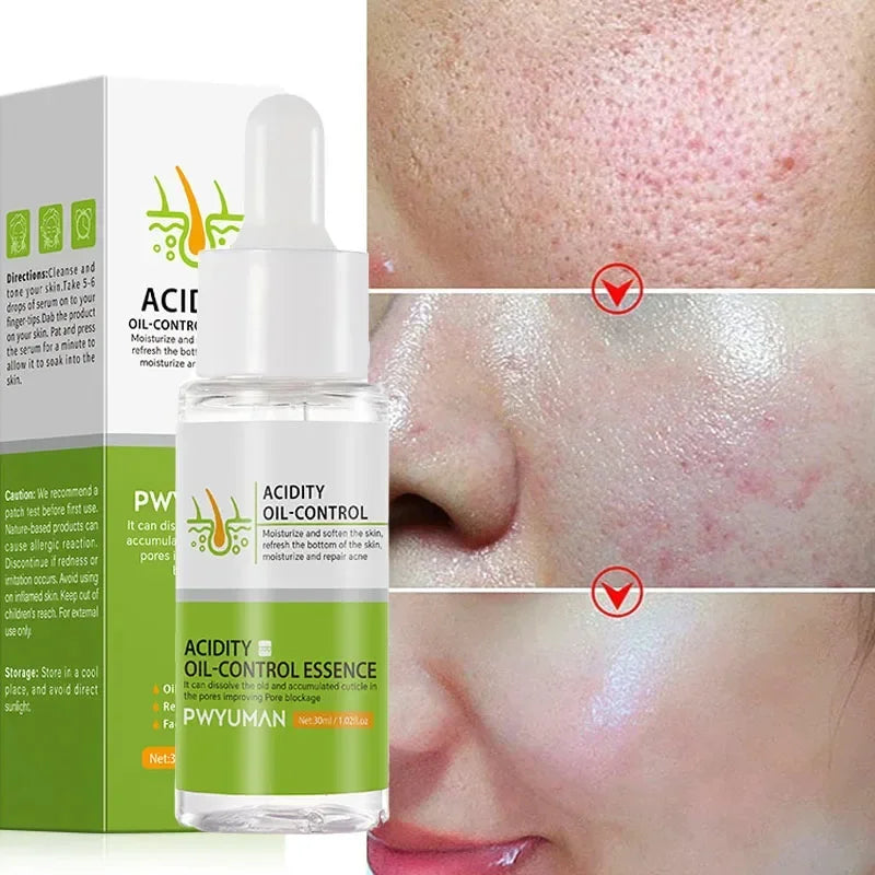 Salicylic Acid Pore Shrinking Cream Eliminate Large Pores Serum Remove Blackhead Acne Repairing Tightening Skin Care Cosmetics