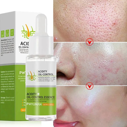 Salicylic Acid Pore Shrinking Cream Eliminate Large Pores Serum Remove Blackhead Acne Repairing Tightening Skin Care Cosmetics