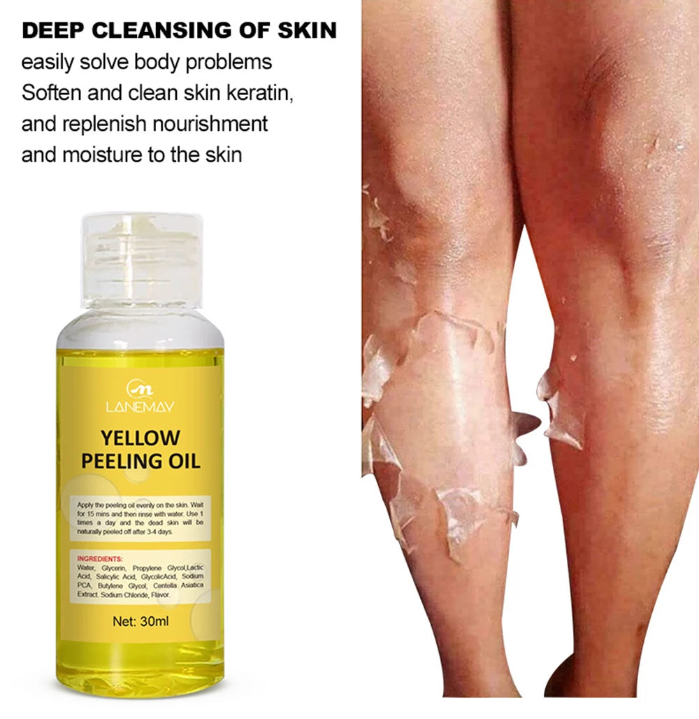Strong Yellow Peeling Oil Bleach Dark Skin Whiten Lotion Lighten Body Elbow Knee Hand Exfoliate Dead Skin Nourish Even Skin Tone