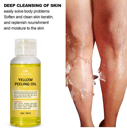 Strong Yellow Peeling Oil Bleach Dark Skin Whiten Lotion Lighten Body Elbow Knee Hand Exfoliate Dead Skin Nourish Even Skin Tone