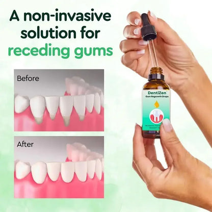30ml Quickly Repair Of Cavities Caries Drops Serum Teeth Remove Yellow Plaque Stains Relieve Gums Decay Serum