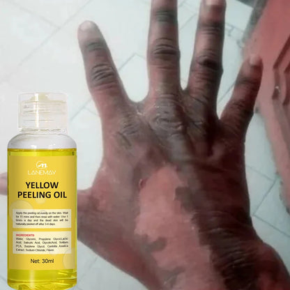 Strong Yellow Peeling Oil Bleach Dark Skin Whiten Lotion Lighten Body Elbow Knee Hand Exfoliate Dead Skin Nourish Even Skin Tone