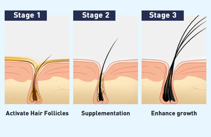 Eyebrow Eyelash Growth Serum Fast Growing Prevent Hair Loss Damaged Treatment Prevent Baldness Fuller Thicker Eye Care Makeup