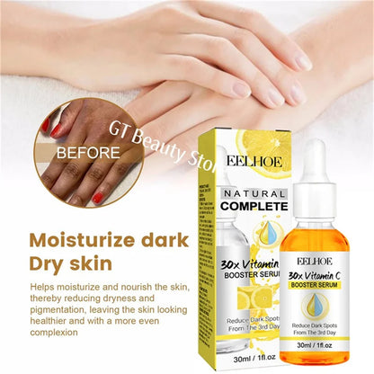 Dark Knuckles Fast Brighten Serum Elbows Hand Knuckle Brightening Serum Knee Black Skin Quickly Lighten Stains Remover Essence