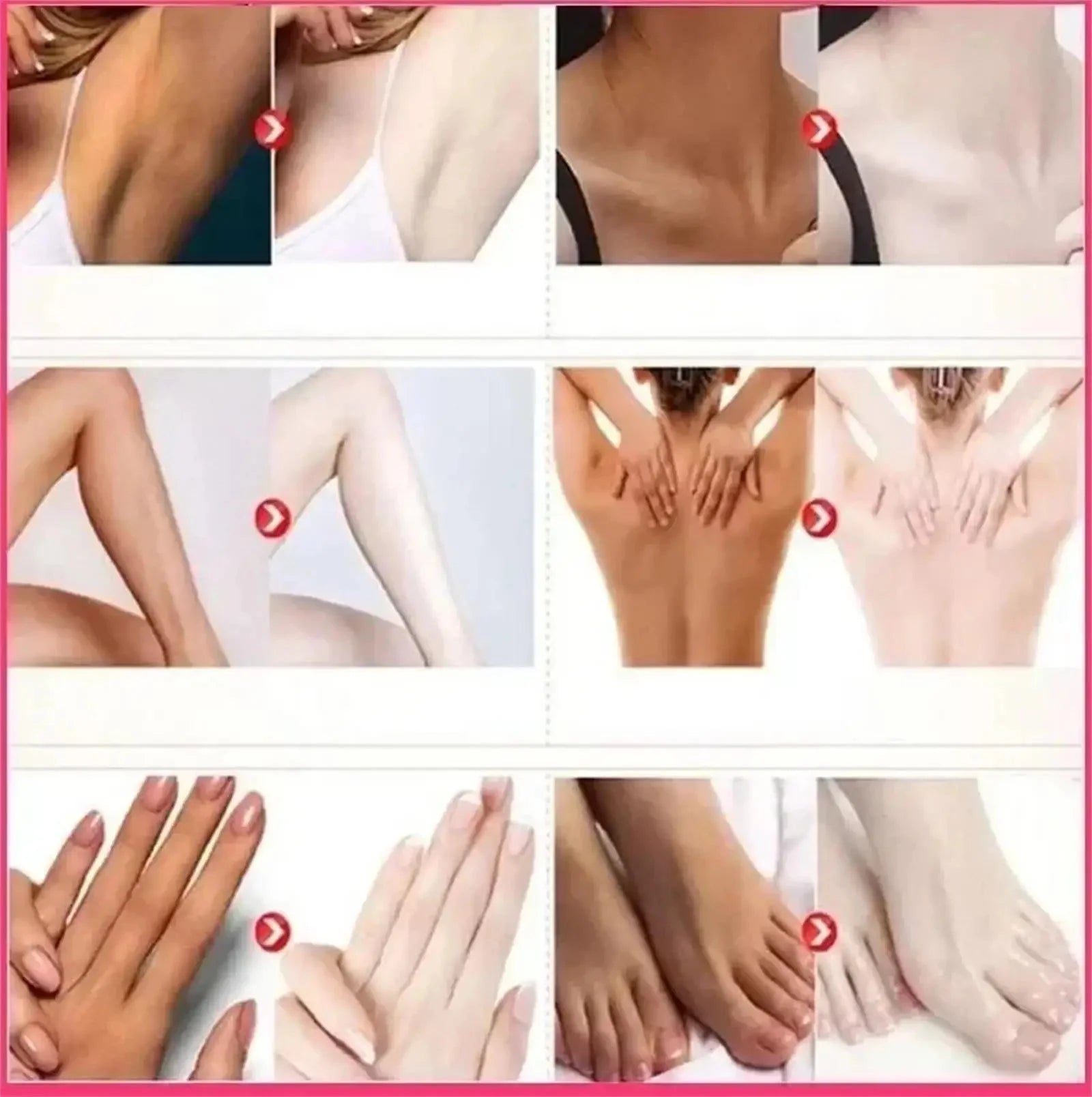 Nicotinamide Brightening Cream For Dark Skin Effective Lighten Thigh Inner Bleach Remove Melanin Private Parts Brighten Cream