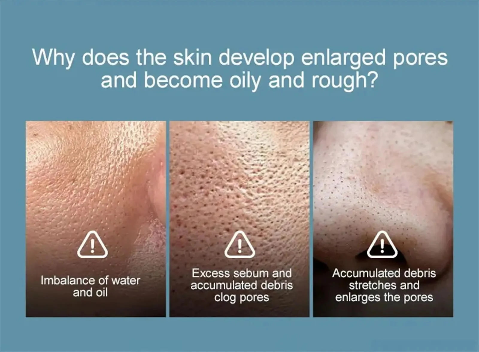 Salicylic Acid Pore Shrinking Cream Reduce Large Pore Tighten Refining Face Repair Rough Dull Pore Brighten Moisturize Skin Care