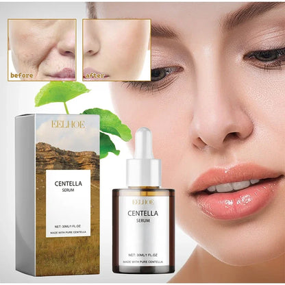 Korean Centella Asiatica Face Serum Nourish Dry Skin Smoothing Rejuvenation Skin Brightening Whitening Cream Facial Moisturizer