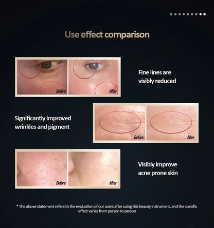 LED Photon Radio Frequency EMS Skin Rejuvenation Thin Face Firming Therapy Facial Skin Lifting Massage Beauty Instrument