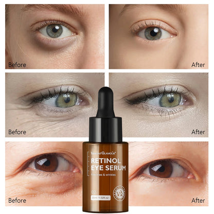 Anti Wrinkle Retinol Eye Serum Dark Circle Eye Bags Remover Whitening Brightening Skin Moisturizer Lightening Cream Eye Care