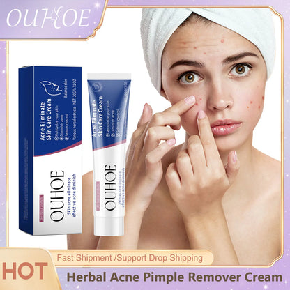 Pimple Acne Treatment Face Cream Nourish Balance Oil Control Refreshing Repairing Pimple Remover Acne Removing Cleansing Cream