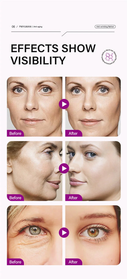 Retinol Against Wrinkles Serum Remove Wrinkle Firming Fade Fine Lines Anti Aging Improve Laugh Line Moisturizing Skin Care Korea