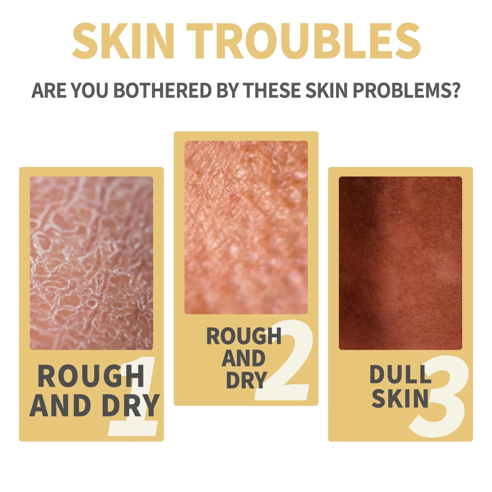 Strong Yellow Peeling Oil Bleach Dark Skin Whiten Lotion Lighten Body Elbow Knee Hand Exfoliate Dead Skin Nourish Even Skin Tone