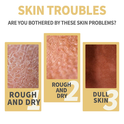 Strong Yellow Peeling Oil Bleach Dark Skin Whiten Lotion Lighten Body Elbow Knee Hand Exfoliate Dead Skin Nourish Even Skin Tone