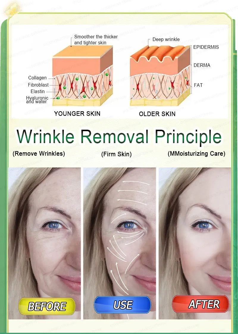 wrinkles disappeared