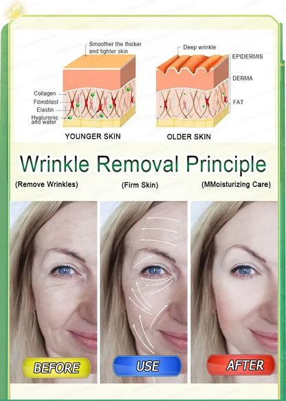 wrinkles disappeared