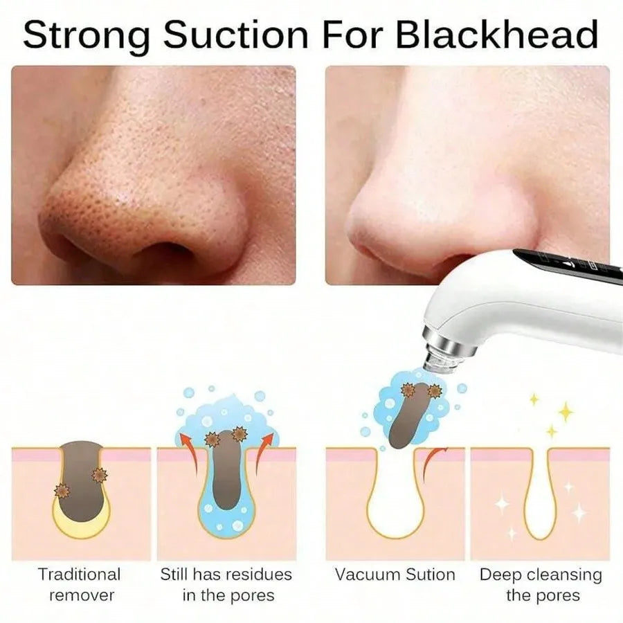 Face Beauty Pore Vacuum Facial Cleaner, Blackhead Remover, USB Charging Water Circulation Facial Cleaning Tool