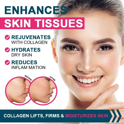 Multiple Collagen Complex - Types I, II, III, V, and X - Hair, Skin, Nail, Bones, Joint Health Support