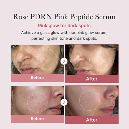 PDRN PINK PEPTLDE SERUM Pink Peptide Collagen Facial Hydrating Moisturizing