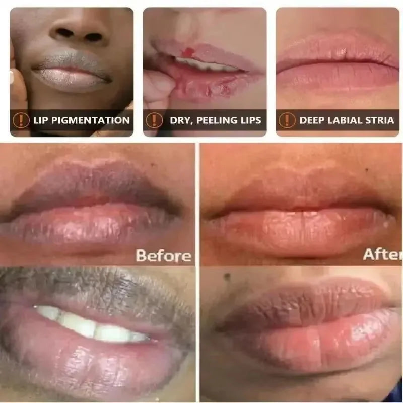 Exfoliating Lip Treatment Mask Gloss - Lightening Melanin Dark Lip Balm Remove Pink Moisturizing Reduce Lip Lines Improve Drynes