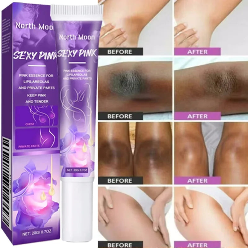 Nicotinamide Brightening Cream For Dark Skin Effective Lighten Thigh Inner Bleach Remove Melanin Private Parts Brighten Cream 1PC