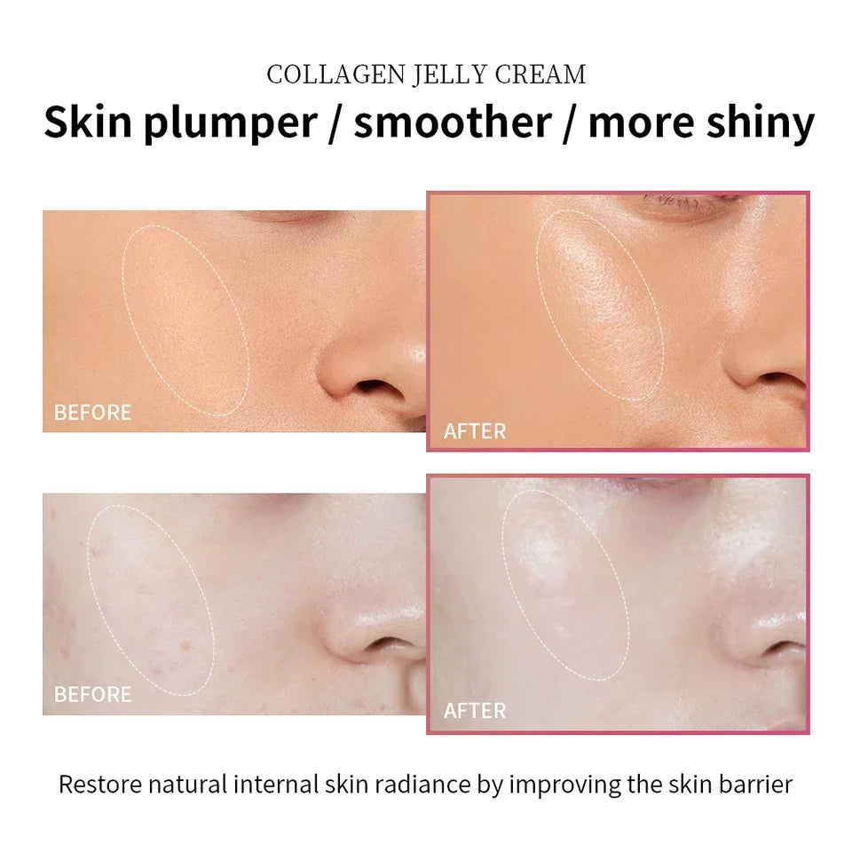 Collagen Jelly Cream Niacinamide Tightening Soothing Moisturizing Anti-Aging Firmness Hydration Skincare 100ml Face Gel