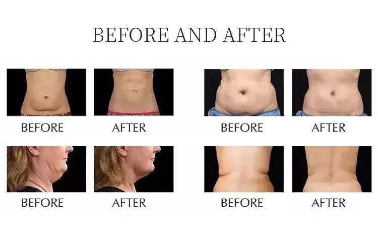 Fast slim 10 n1 80K cavitation Lipo rf ultrasonic cavitation slimming machine 80 k professional 6-1