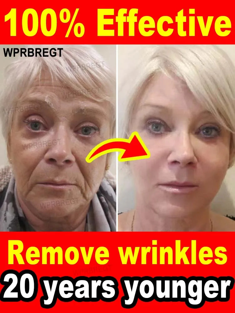 wrinkles disappeared