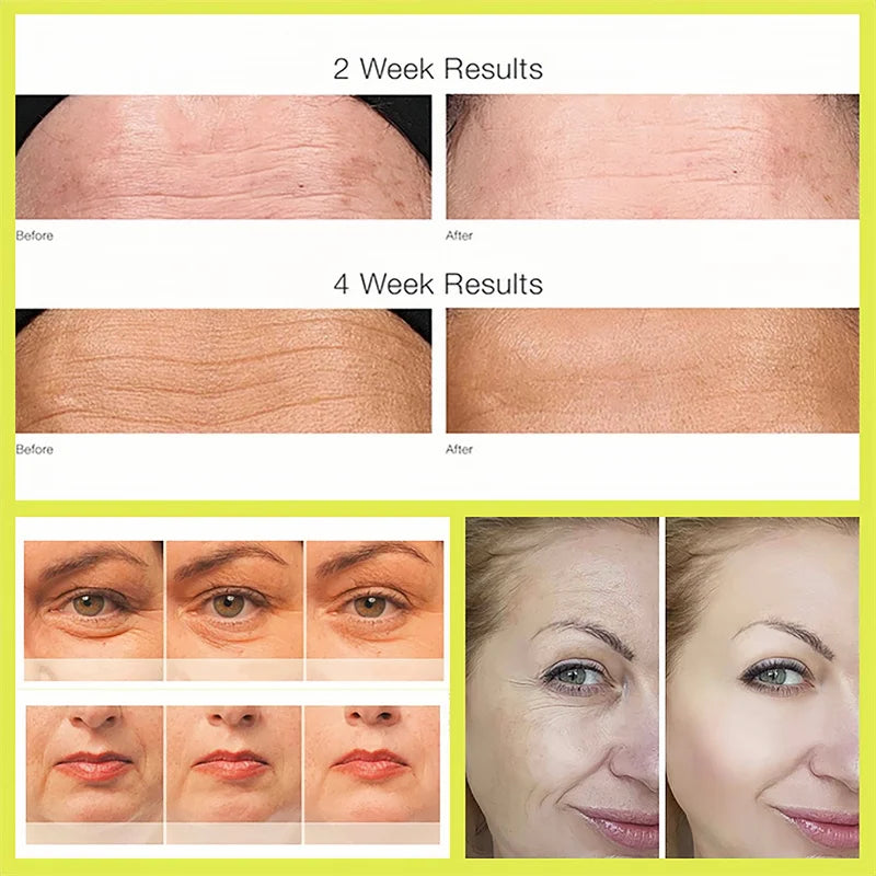 Retinol Shot Tightening Booster For Firm Skin Face Serum Eye Cream Moisturizing Anti Aging Wrinkles Dark Circles Puffiness Care