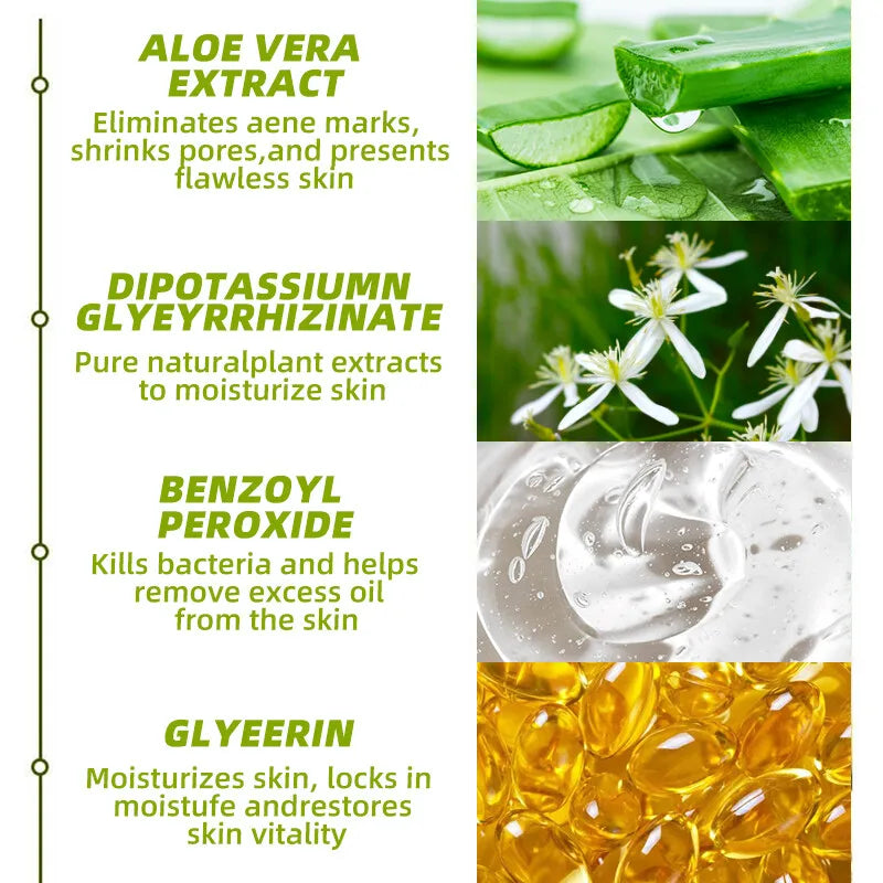 30g Acne Cream soothes, hydrates, helps regulate oil, reduces redness, and enhances skin texture with a moisturizing feel