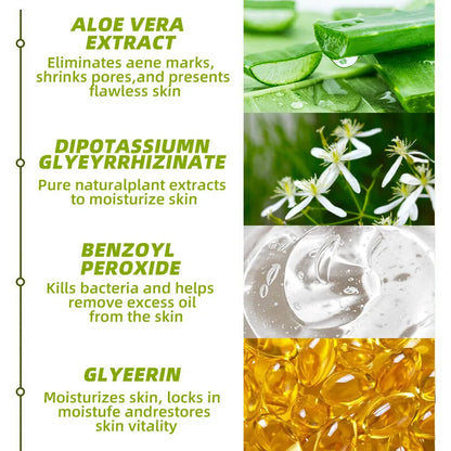 30g Acne Cream soothes, hydrates, helps regulate oil, reduces redness, and enhances skin texture with a moisturizing feel