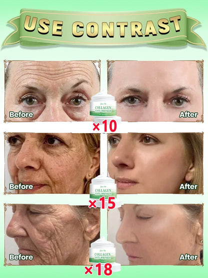 The effect is very good. The wrinkles are gone.