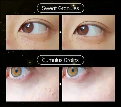Fat Granules Remover Eye Cream Effective Remove Fat Granules Puffiness Anti-Particles Milia Remover Product Repair Eye Skin Care