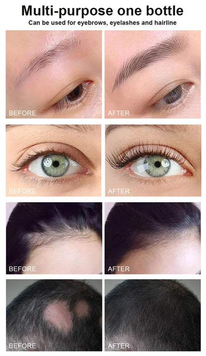 Eyebrow Eyelash Growth Serum Fast Growing Prevent Hair Loss Damaged Treatment Prevent Baldness Fuller Thicker Eye Care Makeup