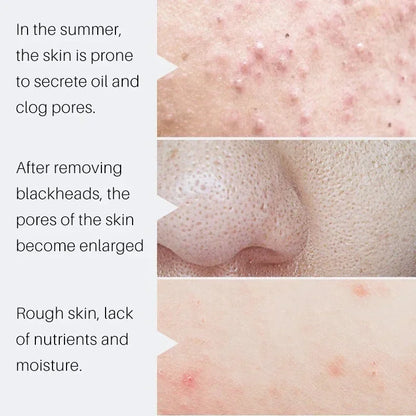 Salicylic Acid Pore Shrinking Cream Eliminate Large Pores Serum Remove Blackhead Acne Repairing Tightening Skin Care Cosmetics