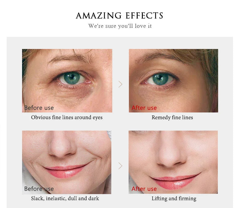 ARTISCARE 24K Gold SkinCare SET Face Cream Moisturizing Serum Dark Circles Essence Korean Skin Care Products