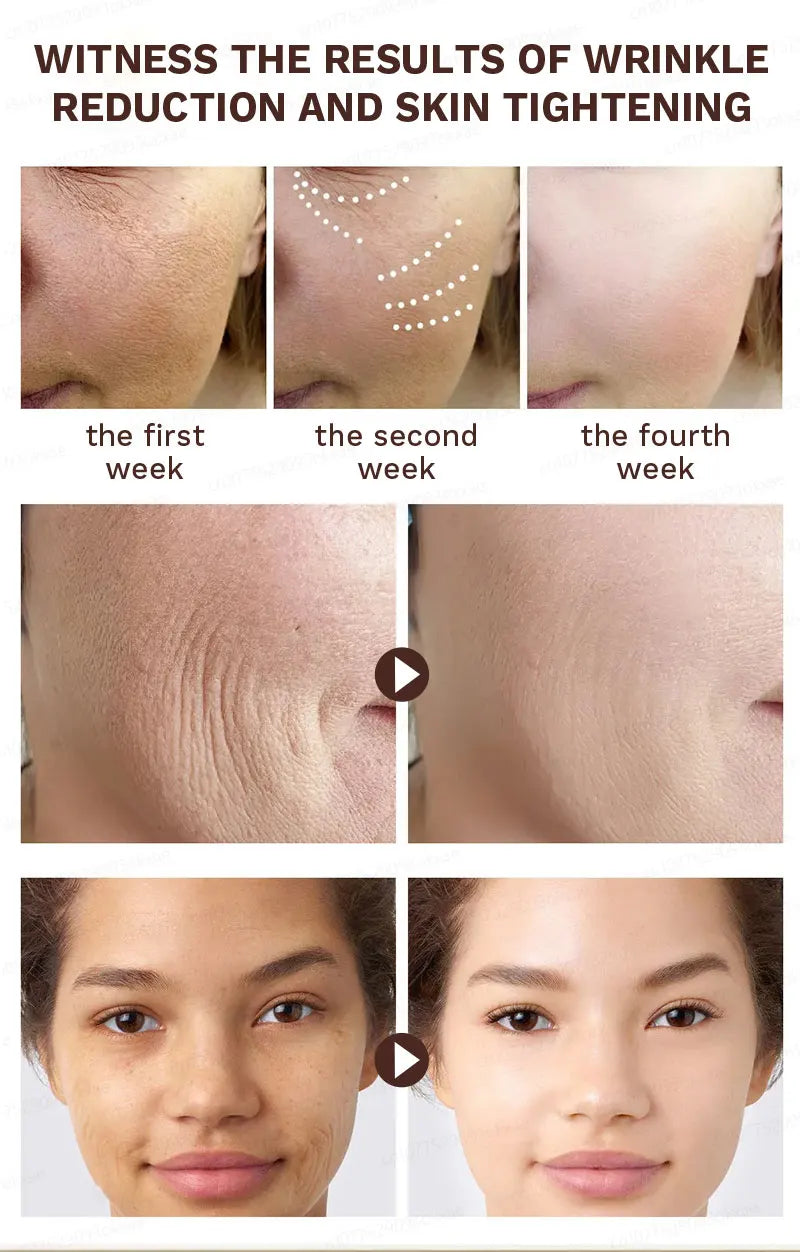 No wrinkles, 20 years younger